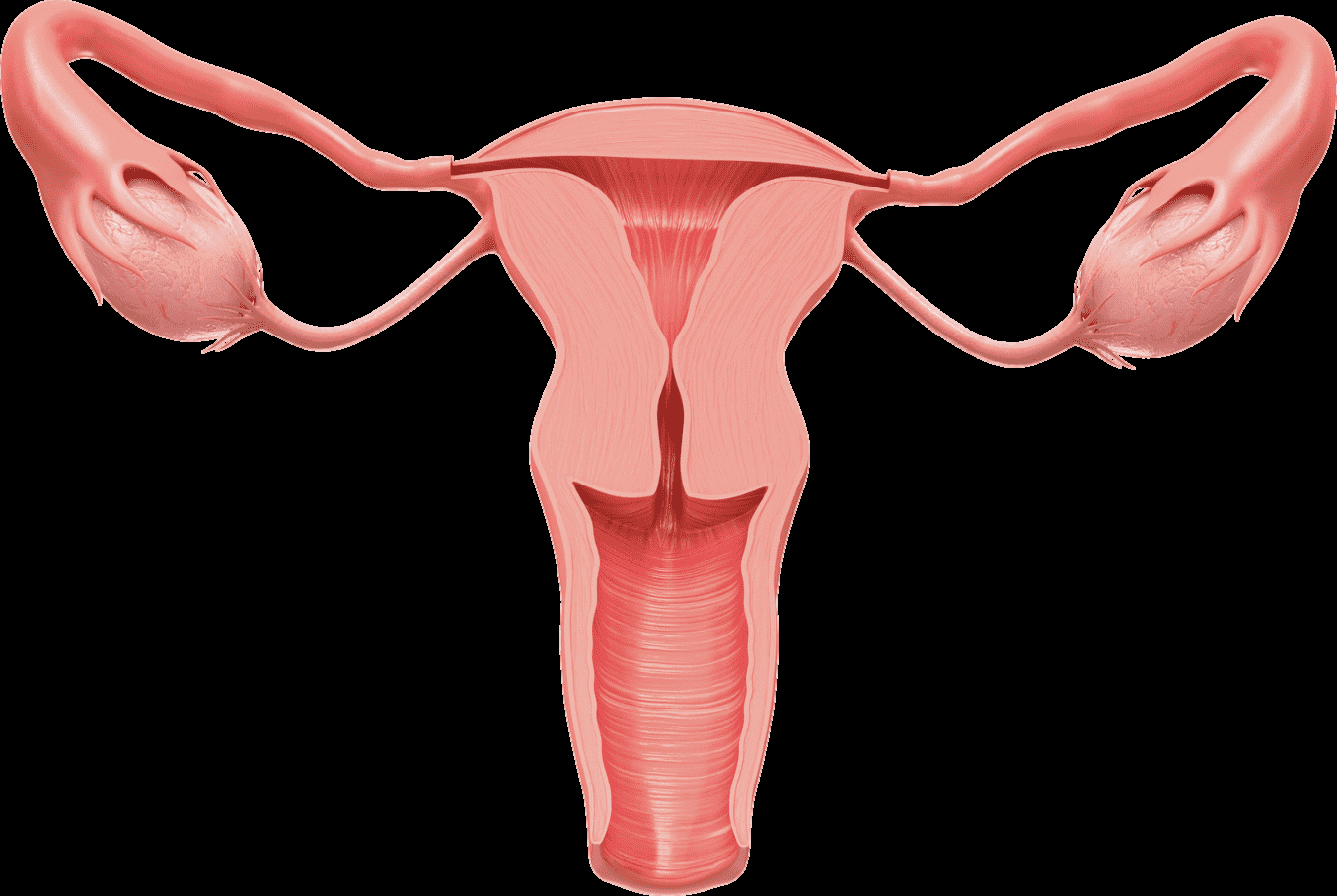 PCOS / PCOD homeopathy treatment