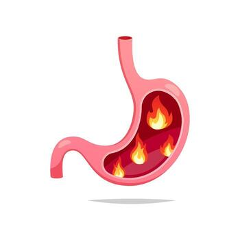 GERD homeopathy treatment